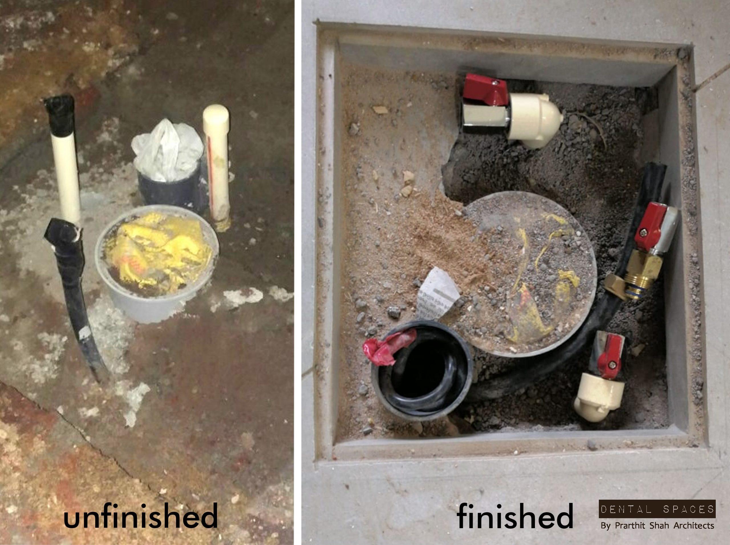 dental chair plumbing india